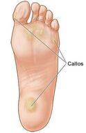 Callos
